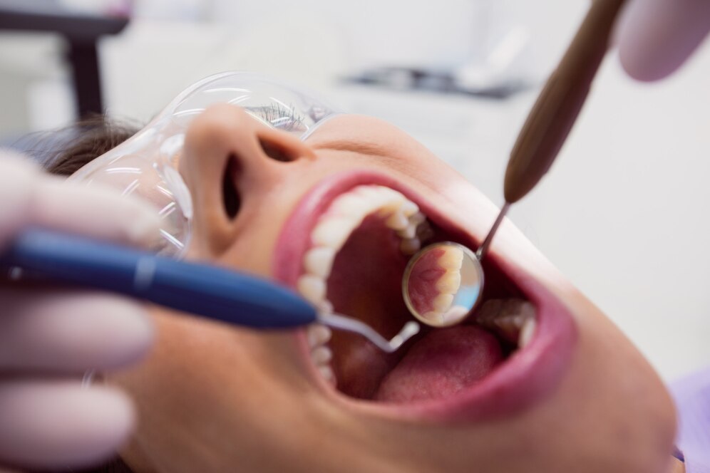 Fillings